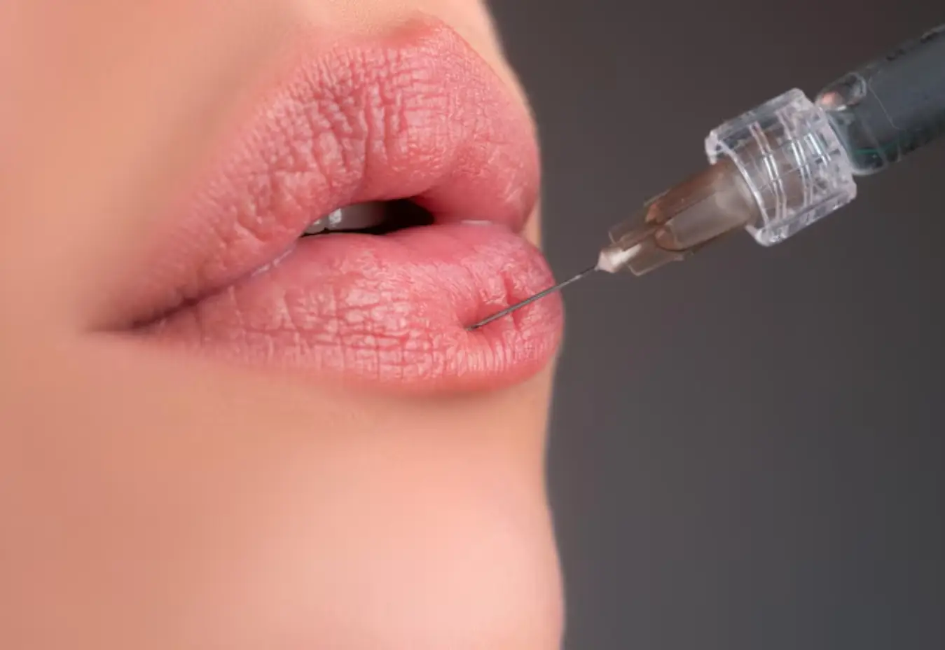 best lip flip medspa services nyc