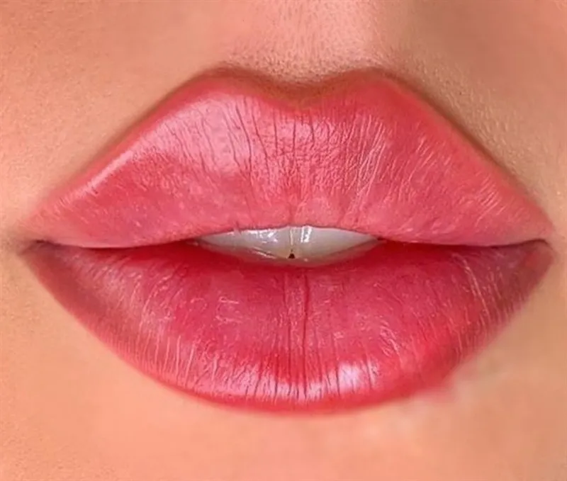 best russian lip filler nyc medspa trending
